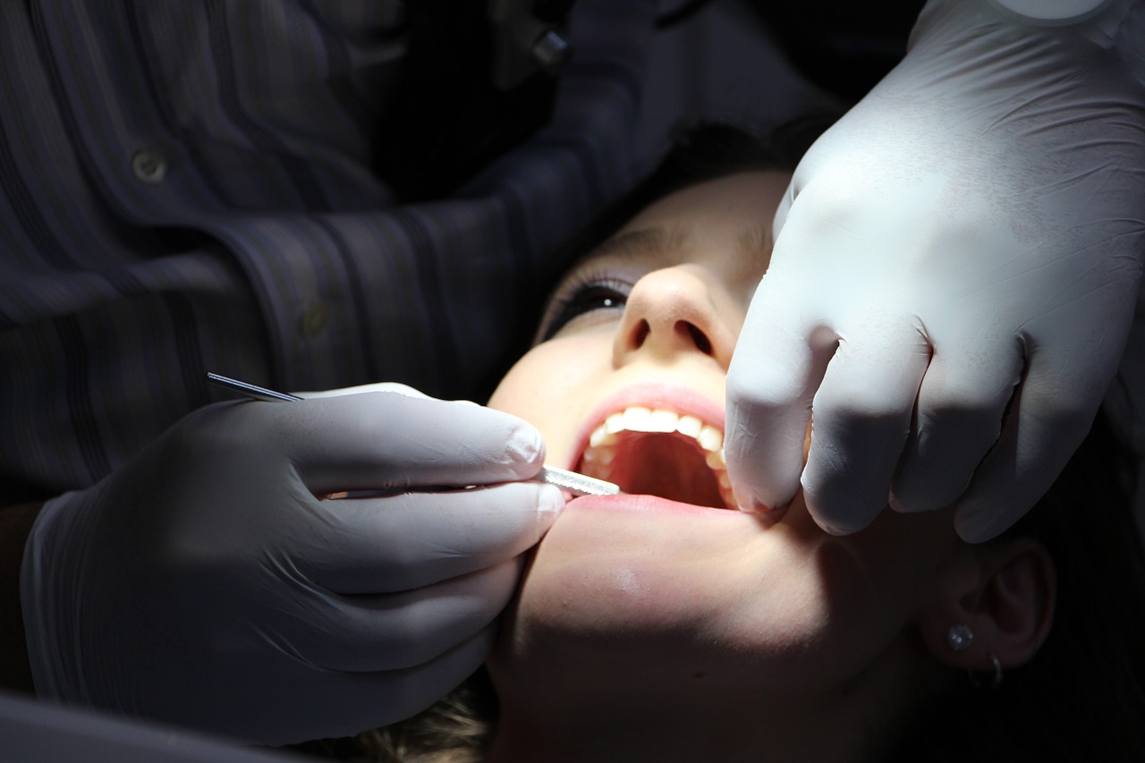 Cena implantów zębowych na całą szczękę
